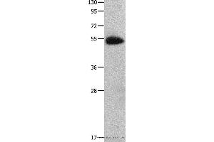 Western blot analysis of Human fetal muscle tissue  , using CX3CR1 Polyclonal Antibody at dilution of 1:200 (CX3CR1 antibody)