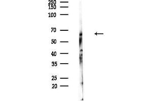 Western blot analysis of lysates from Hela cells(heat-shock,45 min treatment), using Cytochrome P450 2S1 Antibody at 1/1000 dilution.