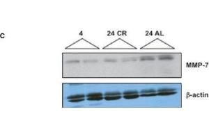 Age-dependent changes in MMP/TIMP expression in the kidney. (MMP7 antibody  (C-Term))