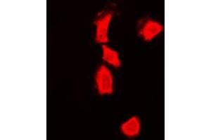 Immunofluorescent analysis of p53 staining in HeLa cells. (p53 antibody  (C-Term))