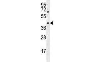 Western Blotting (WB) image for anti-alpha-Methylacyl-CoA Racemase (AMACR) (AA 323-351) antibody (ABIN3029920)