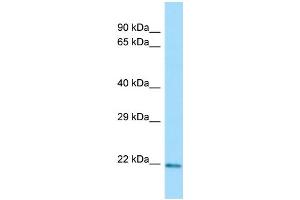 WB Suggested Anti-CLEC3A Antibody Titration: 1. (CLEC3A antibody  (N-Term))