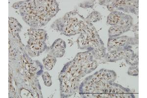 Immunoperoxidase of monoclonal antibody to PAPSS2 on formalin-fixed paraffin-embedded human placenta.