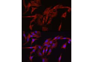 Immunofluorescence analysis of A-549 cells using TMPRSS2 Rabbit pAb (ABIN6132728, ABIN6149286, ABIN6149287 and ABIN6219138) at dilution of 1:50 (40x lens). (TMPRSS2 antibody  (AA 140-400))