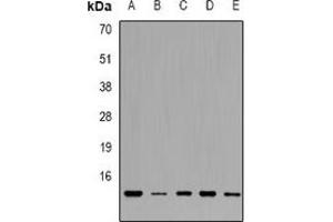Western blot analysis of TRP14 expression in HL60 (A), Raji (B), K562 (C), SW480 (D), A549 (E) whole cell lysates.
