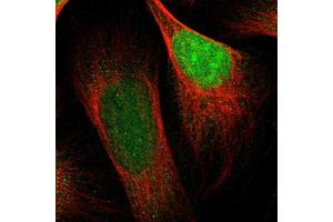 Immunofluorescent staining of human cell line U-2 OS shows localization to nucleus. (CBX5 antibody  (AA 30-137))