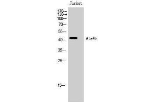 Western Blotting (WB) image for anti-Autophagy related 4B Cysteine Peptidase (ATG4B) (Internal Region) antibody (ABIN3173943) (ATG4B antibody  (Internal Region))