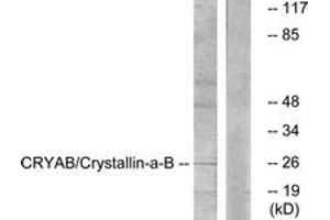 Western blot analysis of extracts from K562 cells, treated with Ca2+ 40nM 30', using CRYAB (Ab-59) Antibody. (CRYAB antibody  (AA 31-80))