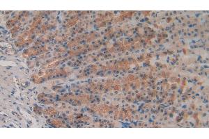 Detection of MMP3 in Rat Stomach Tissue using Polyclonal Antibody to Matrix Metalloproteinase 3 (MMP3) (MMP3 antibody  (AA 278-450))