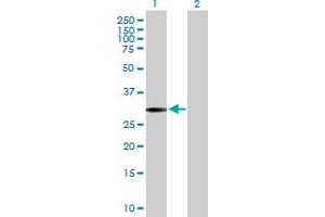 Western Blot analysis of SLC22A24 expression in transfected 293T cell line by SLC22A24 MaxPab polyclonal antibody. (SLC22A24 antibody  (AA 1-322))