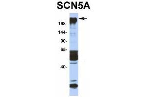 Host:  Rabbit  Target Name:  SCN5A  Sample Type:  Human Fetal Muscle  Antibody Dilution:  1. (SCN5A antibody  (N-Term))