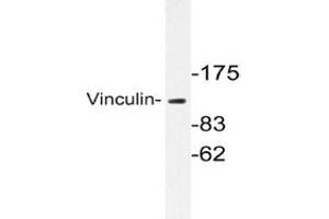Image no. 1 for anti-Vinculin (VCL) antibody (ABIN272104) (Vinculin antibody)