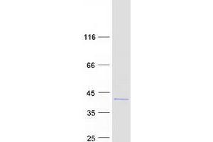 Chromosome 20 Open Reading Frame 111 (C20orf111) protein (Myc-DYKDDDDK Tag)