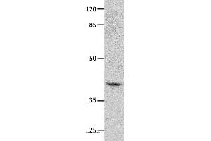Western blot analysis of Human leiomyosarcoma tissue, using GNA11 Polyclonal Antibody at dilution of 1:450 (GNA11 antibody)