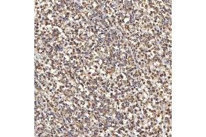 IHC analysis of TST using anti-TST antibody (ABIN7599105).