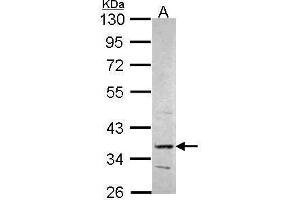 WB Image Sample (30 ug of whole cell lysate) A: Hep G2 , 10% SDS PAGE PRPS2 antibody antibody diluted at 1:1000 (PRPS2 antibody)
