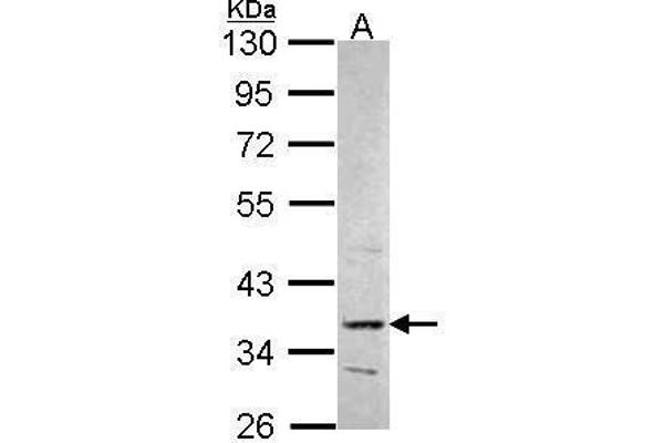 PRPS2 antibody