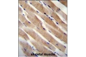 RHEB Antibody (C-term) (ABIN655712 and ABIN2845163) immunohistochemistry analysis in formalin fixed and paraffin embedded human skeletal muscle followed by peroxidase conjugation of the secondary antibody and DAB staining. (RHEB antibody  (C-Term))