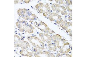 Immunohistochemistry of paraffin-embedded human gastric using SPICE1 antibody at dilution of 1:100 (x40 lens). (SPICE1 antibody)