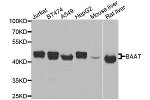 Western blot analysis of extracts of various cell lines, using BAAT antibody. (BAAT antibody  (AA 309-418))