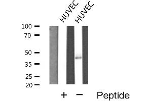 Western blot analysis of Cathepsin E expression in HUVEC cells (Cathepsin E antibody  (Internal Region))