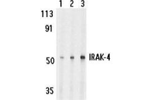 Western blot analysis of IRAK-4 in HeLa cell lysate with AP30442PU-N IRAK-4 antibody at 1 (lane 1), 2 (lane 2), and 4 (lane 3) μg/ml, respectively. (IRAK4 antibody)