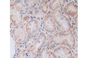 Figure. (HSPA12B antibody  (AA 1-217))