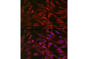 Immunofluorescence analysis of NIH/3T3 cells using IRS2 Rabbit pAb (ABIN6128094, ABIN6142544, ABIN6142545 and ABIN6223949) at dilution of 1:25 (40x lens). (IRS2 antibody  (AA 510-650))