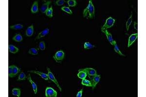 Immunofluorescent analysis of Hela cells using ABIN7176604 at dilution of 1:100 and Alexa Fluor 488-congugated AffiniPure Goat Anti-Rabbit IgG(H+L) (SLUG antibody  (AA 12-124))