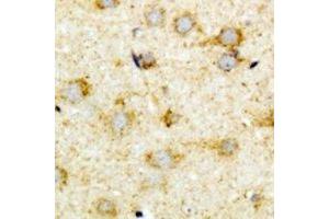 Immunohistochemical analysis of ACOX1 staining in mouse brain formalin fixed paraffin embedded tissue section.