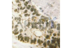Immunohistochemistry (IHC) image for anti-Runt-Related Transcription Factor 1 (RUNX1) (pSer304) antibody (ABIN6256258)