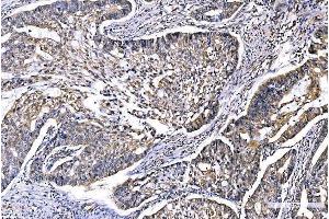 IHC analysis of GFPT1 using anti-GFPT1 antibody (ABIN7602887).