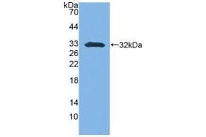 Detection of Recombinant SFN, Mouse using Polyclonal Antibody to Stratifin (SFN) (14-3-3 sigma/SFN antibody  (AA 1-249))