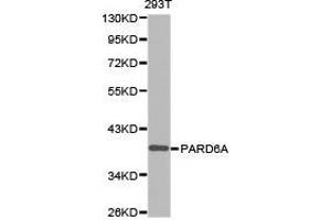 Western Blotting (WB) image for anti-Par-6 Partitioning Defective 6 Homolog alpha (PARD6A) antibody (ABIN1874031) (PARD6A antibody)