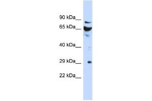 WB Suggested Anti-DCUN1D3 Antibody Titration: 0. (DCUN1D3 antibody  (N-Term))