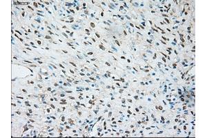 Immunohistochemical staining of paraffin-embedded Kidney tissue using anti-TRPM4mouse monoclonal antibody.