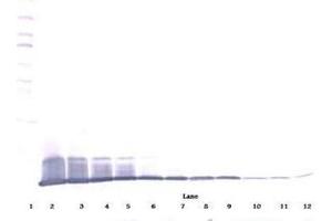 Image no. 4 for anti-Interleukin 8 (IL8) antibody (ABIN465357) (IL-8 antibody)