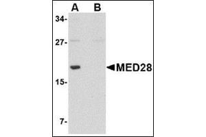 Western blot analysis of MED28 in human brain tissue lysate with this product at 1 μg/ml in (A) the absence and (B) the presence of blocking peptide. (MED28 antibody  (Center))