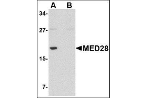 MED28 anticorps  (Center)