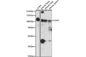 Western blot analysis of extracts of various cell lines, using V antibody  at 1:1000 dilution. (VAV3 antibody  (AA 560-680))