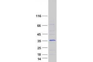 Validation with Western Blot (FHL2 Protein (Transcript Variant 5) (Myc-DYKDDDDK Tag))