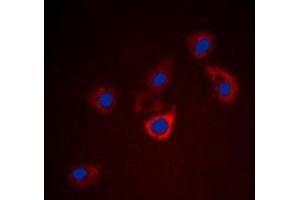 Immunofluorescent analysis of BCL2 staining in HeLa cells. (Bcl-2 antibody  (Center))