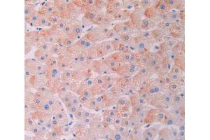 IHC-P analysis of liver tissue, with DAB staining. (LGALS9B antibody  (AA 17-148))