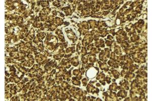 ABIN6279411 at 1/100 staining Mouse pancreas tissue by IHC-P. (NEIL2 antibody  (Internal Region))