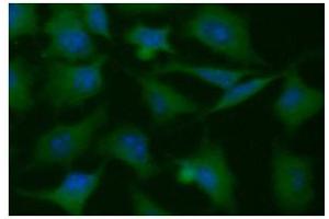 ICC/IF analysis of PGAM1 in HeLa cells line, stained with DAPI (Blue) for nucleus staining and monoclonal anti-human PGAM1 antibody (1:100) with goat anti-mouse IgG-Alexa fluor 488 conjugate (Green). (PGAM1 antibody  (AA 1-254))