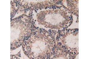 Used in DAB staining on fromalin fixed paraffin- embedded testis tissue (SPTAN1 antibody  (AA 402-599))