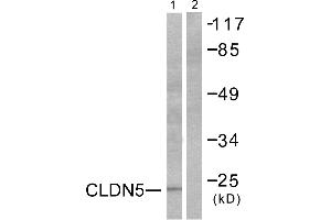 Western blot analysis of extracts from A549 cells, using Claudin 5 antibody (#C0145). (Claudin 5 antibody)
