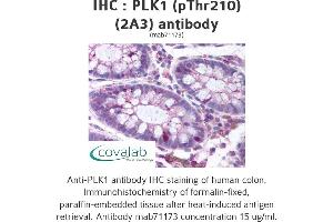 Image no. 1 for anti-Polo-Like Kinase 1 (PLK1) (pThr210) antibody (ABIN1724011) (PLK1 antibody  (pThr210))