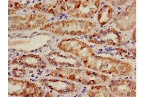 Immunohistochemistry of paraffin-embedded human kidney tissue using ABIN7159169 at dilution of 1:100 (Medium-Chain Specific Acyl-CoA Dehydrogenase, Mitochondrial (AA 26-421) antibody)