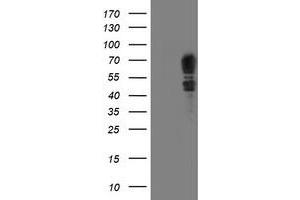 HEK293T cells were transfected with the pCMV6-ENTRY control (Left lane) or pCMV6-ENTRY SCHIP1 (Right lane) cDNA for 48 hrs and lysed. (SCHIP1 antibody)